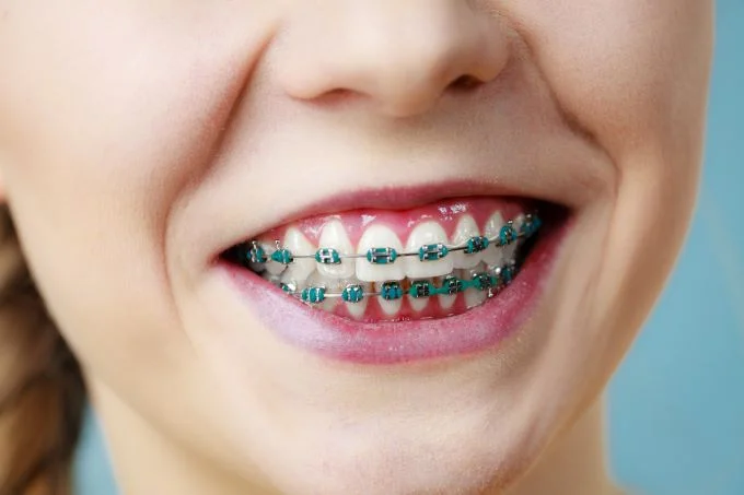 Orthodontics