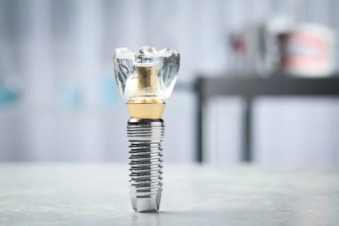 Dental Implants