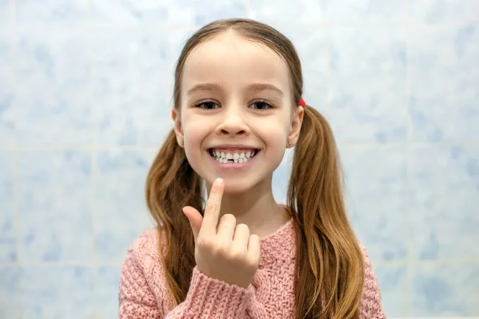 ICON Treatment for Fluorosis