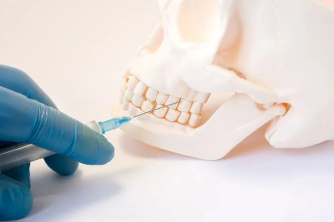 Oral Sedation