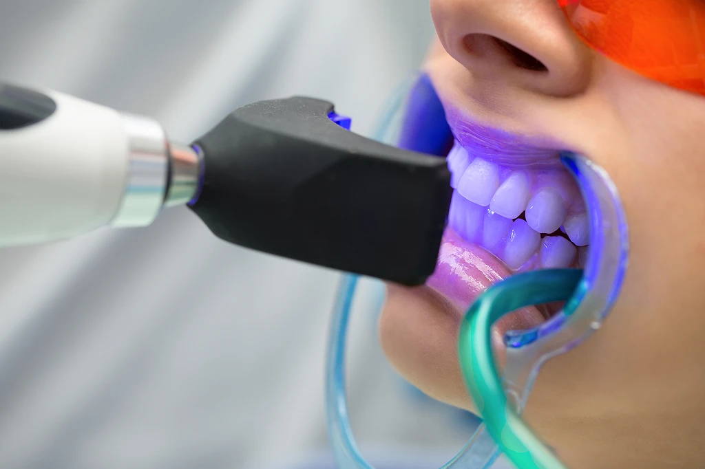 Zoom Teeth Whitening